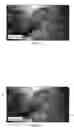 Fig. 03 - METHOD AND SYSTEM FOR COMBINING COMPUTER VISION TECHNIQUES TO IMPROVE SEGMENTATION AND CLASSIFICATION OF A SURGICAL SITE