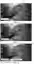 Fig. 04 - METHOD AND SYSTEM FOR COMBINING COMPUTER VISION TECHNIQUES TO IMPROVE SEGMENTATION AND CLASSIFICATION OF A SURGICAL SITE
