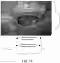 Fig. 07 - METHOD AND SYSTEM FOR COMBINING COMPUTER VISION TECHNIQUES TO IMPROVE SEGMENTATION AND CLASSIFICATION OF A SURGICAL SITE