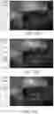 Fig. 10 - METHOD AND SYSTEM FOR COMBINING COMPUTER VISION TECHNIQUES TO IMPROVE SEGMENTATION AND CLASSIFICATION OF A SURGICAL SITE