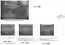 Fig. 11 - METHOD AND SYSTEM FOR COMBINING COMPUTER VISION TECHNIQUES TO IMPROVE SEGMENTATION AND CLASSIFICATION OF A SURGICAL SITE