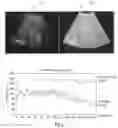 Fig. 02 - Tissue specific time gain compensation methods and systems