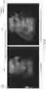 Fig. 08 - Tissue specific time gain compensation methods and systems
