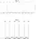 Fig. 03 - Line stripe mismatch detection and three-dimensional reconstruction method and device