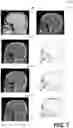Fig. 08 - Methods and systems for translating magnetic resonance images to pseudo computed tomography images