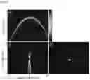 Fig. 06 - Method and device for displaying passive cavitation image