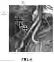 Fig. 05 - METHOD AND APPARATUS FOR INTERACTIVE DISPLAY OF IMAGE POSITIONING, ELECTRONIC DEVICE AND STORAGE MEDIUM