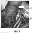 Fig. 06 - METHOD AND APPARATUS FOR INTERACTIVE DISPLAY OF IMAGE POSITIONING, ELECTRONIC DEVICE AND STORAGE MEDIUM