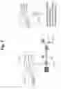 Fig. 07 - OBJECT DETECTION AND RECOGNITION DEVICE, METHOD, AND PROGRAM