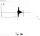Fig. 11 - Device, method and computer program for blind source separation and remixing