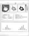 Fig. 01 - Image diagnosis supporting device and image processing method