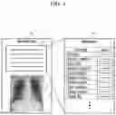 Fig. 04 - Apparatus and method for processing medical image using predicted metadata
