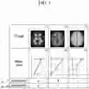 Fig. 05 - Apparatus and method for processing medical image using predicted metadata