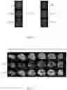 Fig. 04 - TUMOR RECURRENCE PREDICTION DEVICE AND METHOD