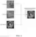 Fig. 05 - TUMOR RECURRENCE PREDICTION DEVICE AND METHOD