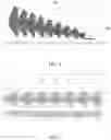 Fig. 05 - Systems and methods for repetitive tuning of matching networks