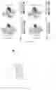Fig. 07 - ANTENNA ASSEMBLY AND ELECTRONIC DEVICE