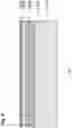 Fig. 05 - LITHIUM NIOBATE OR LITHIUM TANTALATE FBAR STRUCTURE AND FABRICATING METHOD THEREOF