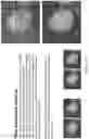 Fig. 175 - Automated application of drift correction to sample studied under electron microscope