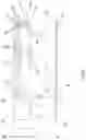 Fig. 02 - RF antenna and hearing device with RF antenna