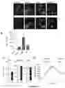 Fig. 07 - MODULATION OF LC3-ASSOCIATED ENDOCYTOSIS PATHWAY AND GENETICALLY MODIFIED NON-HUMAN ANIMALS AS A MODEL OF NEUROINFLAMMATION AND NEURODEGENERATION