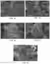 Fig. 08 - COLLOIDAL PLANT POWDER/EXTRACT ENCAPSULATION WITH PECTIN-PROTEIN COACERVATE GELS