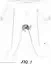 Fig. 02 - GARMENT WITH OBSERVATION PANEL FOR UNDERLYING DIAPER
