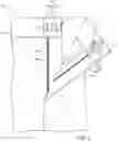 Fig. 03 - LOW PROFILE CLOSURE