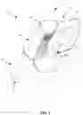 Fig. 02 - A CLEANING SYSTEM COMPRISING A SYSTEM FOR PREVENTING THE MOTOR FROM OVERHEATING AND A METHOD THREFORE