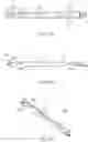 Fig. 06 - Methods for advancing a device through a gastrointestinal tract