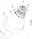 Fig. 34 - Methods for advancing a device through a gastrointestinal tract