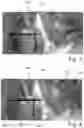 Fig. 03 - Optical filter system for a video endoscope, display system and video endoscope