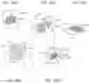 Fig. 28 - CONTROL OF A DISPLAY OUTSIDE THE STERILE FIELD FROM A DEVICE WITHIN THE STERILE FIELD
