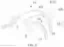 Fig. 03 - Laryngoscope