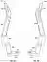 Fig. 13 - SPECULUM WITH SECONDARY BILLS