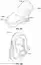 Fig. 15 - SPECULUM WITH SECONDARY BILLS