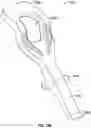 Fig. 17 - SPECULUM WITH SECONDARY BILLS