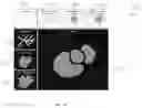 Fig. 10 - DEVICES, SYSTEMS, AND METHODS FOR TUMOR VISUALIZATION AND REMOVAL