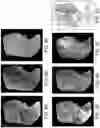 Fig. 09 - DEVICE AND METHODS FOR OPTICAL PATHOLOGY