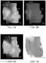 Fig. 10 - DEVICE AND METHODS FOR OPTICAL PATHOLOGY