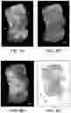 Fig. 11 - DEVICE AND METHODS FOR OPTICAL PATHOLOGY