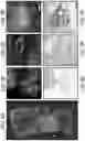 Fig. 12 - DEVICE AND METHODS FOR OPTICAL PATHOLOGY
