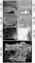 Fig. 13 - DEVICE AND METHODS FOR OPTICAL PATHOLOGY