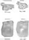 Fig. 17 - DEVICE AND METHODS FOR OPTICAL PATHOLOGY