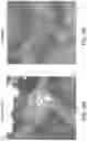 Fig. 18 - DEVICE AND METHODS FOR OPTICAL PATHOLOGY