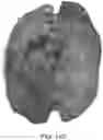 Fig. 19 - DEVICE AND METHODS FOR OPTICAL PATHOLOGY