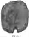 Fig. 20 - DEVICE AND METHODS FOR OPTICAL PATHOLOGY