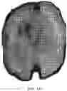 Fig. 21 - DEVICE AND METHODS FOR OPTICAL PATHOLOGY