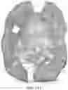 Fig. 22 - DEVICE AND METHODS FOR OPTICAL PATHOLOGY