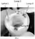 Fig. 06 - Systems and methods for performing frequency-domain photoacoustic imaging